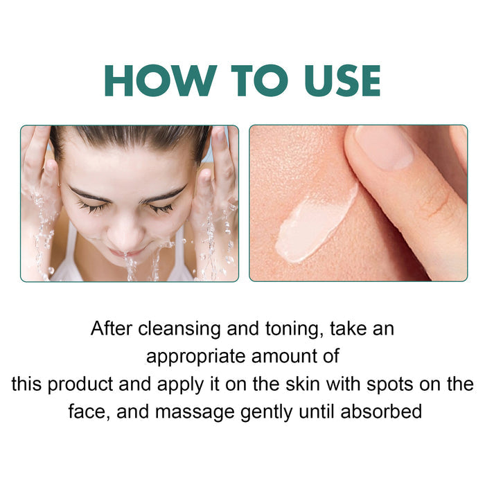 EELHOE Spot Cream – Hydrating Skin & Freckle Whitening EELHOE COSMETICS