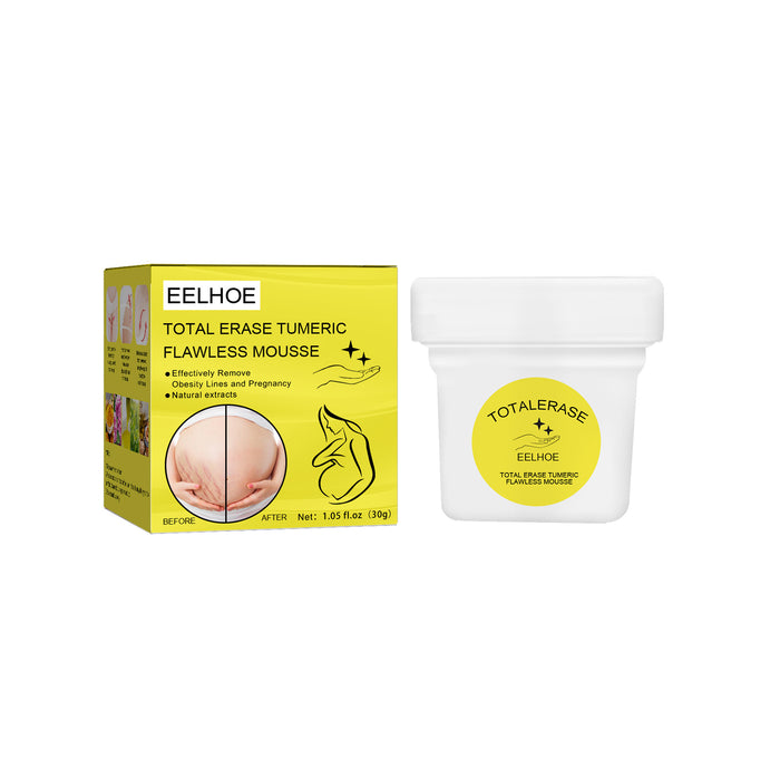 Eelhoe Total Erase Stretch Marks Obesity & Pregnancy Repair CreamEELHOE Total Erase Stretch Marks Cream – Pregnancy & Weight Repair Care EELHOE COSMETICS