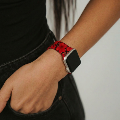 Leopard Hibiscus patterned Apple Watch strap on a persons wrist, hand resting on their hip.