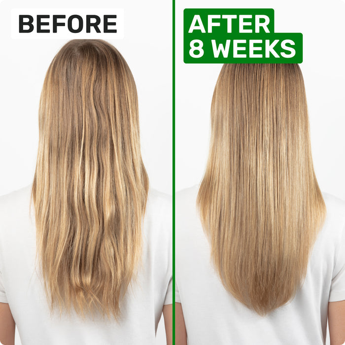 BEFORE
AFTER 8 WEEKS